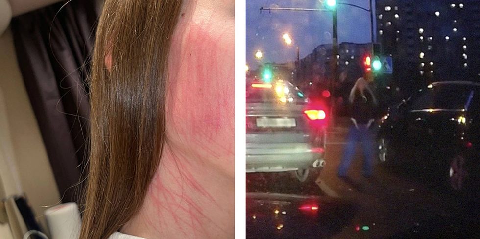 "Расцарапала мне лицо, руки". Женщина на дороге проявила агрессию