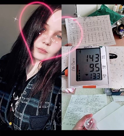 trollejbus tokom udarilo 01